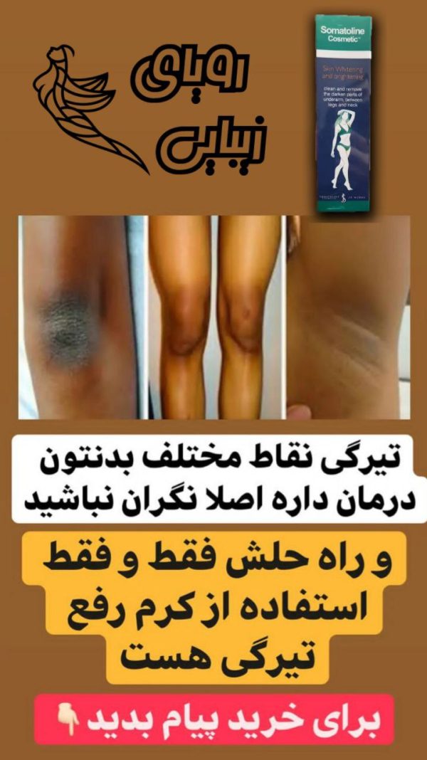 سوماتلین