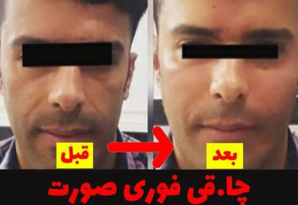 فتفیس جدید فت فیس جدید فتفست فت فیس فت یس گندمی