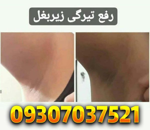 سوماتلین