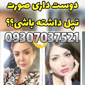 چاقی صورت هات ویتا