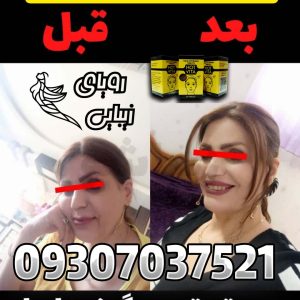 چاقی صورت هات ویتا