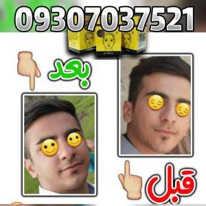 چاقی صورت هات ویتا