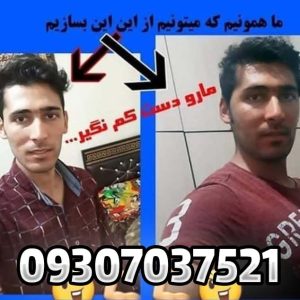 چاقی صورت هات ویتا