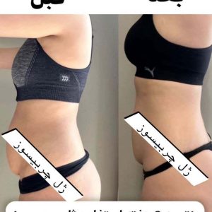 لاغری هات ویتا