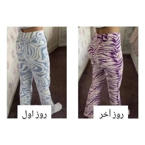 قرص بزرگ کننده ران و باسن