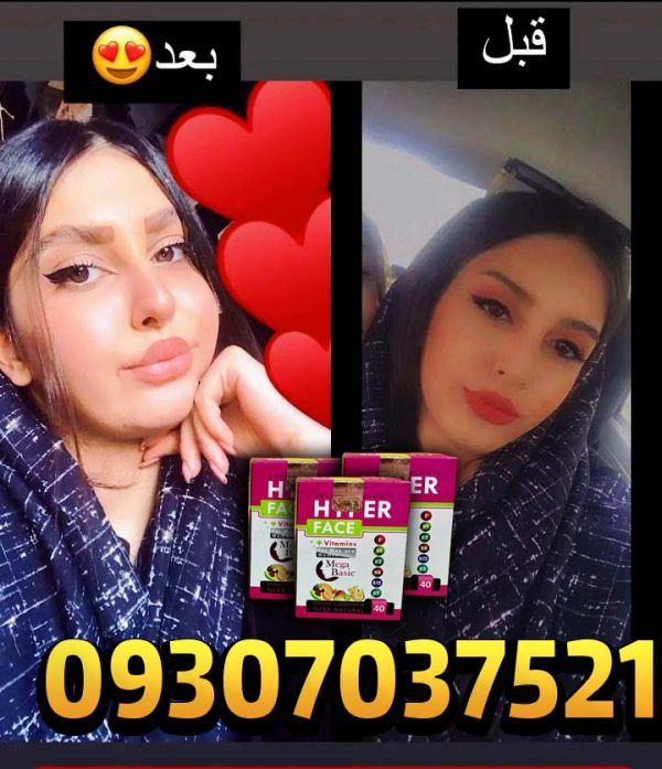 مگابیسیک صورت