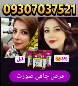 مگابیسیک صورت