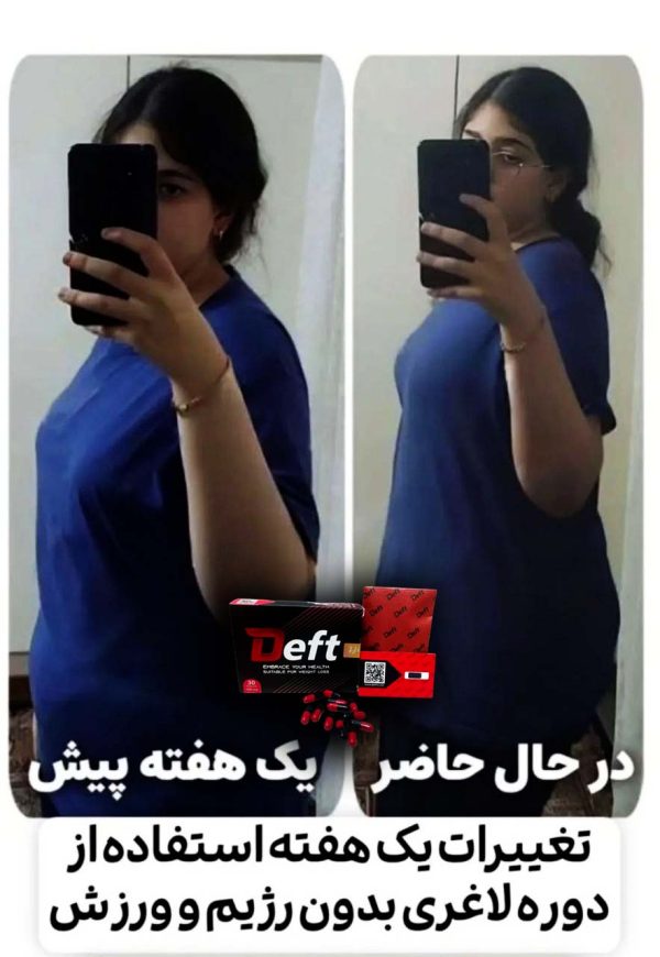 قرص لاغری دفت