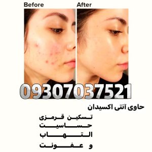 کرم حلزون کوزارکس 9 کرم حلزون کوزارکس